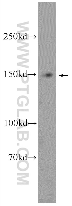 Western Blot (WB) analysis of SW 1990 cells using MTMR3 Polyclonal antibody (21336-1-AP)