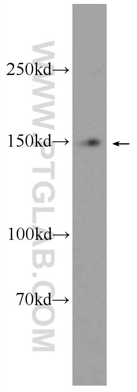 Western Blot (WB) analysis of SW 1990 cells using MTMR3 Polyclonal antibody (21336-1-AP)