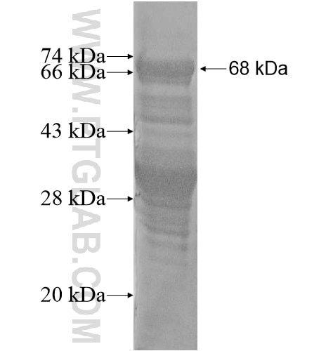 MTMR3 fusion protein Ag15514 SDS-PAGE