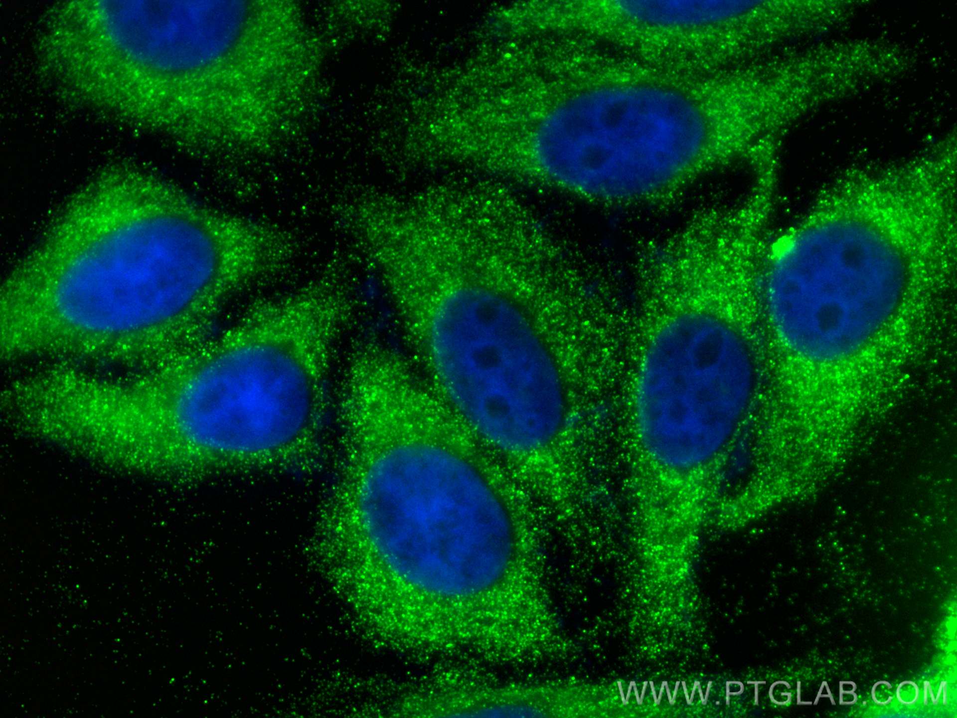 Immunofluorescence (IF) / fluorescent staining of HepG2 cells using MTMR4 Polyclonal antibody (13488-1-AP)