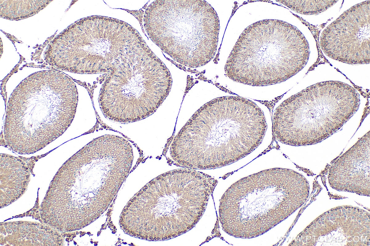 Immunohistochemistry (IHC) staining of rat testis tissue using MTMR4 Polyclonal antibody (13488-1-AP)
