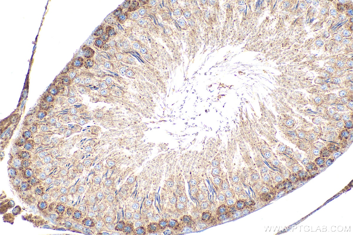 Immunohistochemistry (IHC) staining of rat testis tissue using MTMR4 Polyclonal antibody (13488-1-AP)