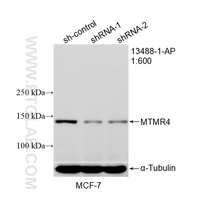 WB result of MTMR4 antibody (13488-1-AP; 1:600; incubated at room temperature for 1.5 hours) with sh-Control and sh-MTMR4 transfected MCF-7 cells. Western Blot (WB) analysis of MCF-7 cells using MTMR4 Polyclonal antibody (13488-1-AP)