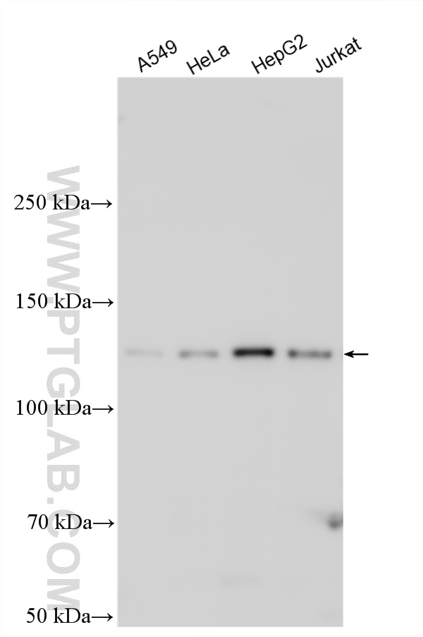 Western Blot (WB) analysis of various lysates using MTMR4 Polyclonal antibody (13488-1-AP)