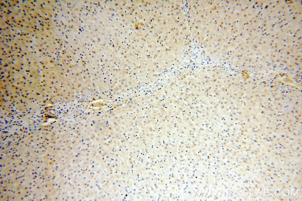 IHC staining of human liver using 13684-1-AP