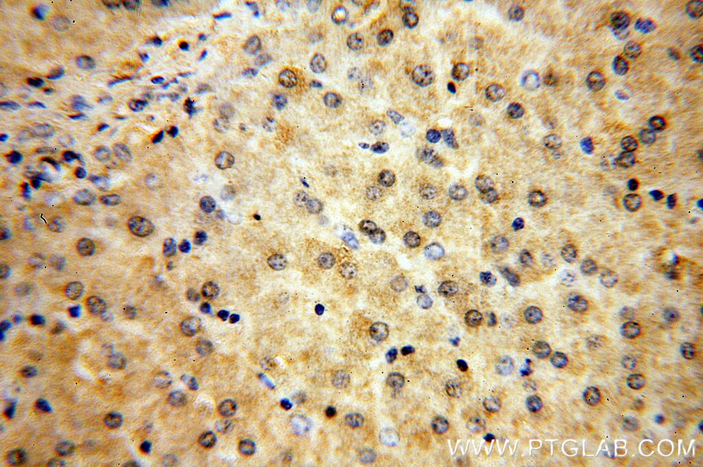 Immunohistochemistry (IHC) staining of human liver tissue using MTMR6 Polyclonal antibody (13684-1-AP)