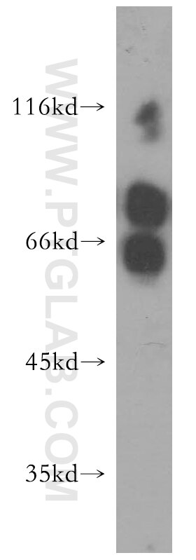 Western Blot (WB) analysis of human heart tissue using MTMR6 Polyclonal antibody (13684-1-AP)