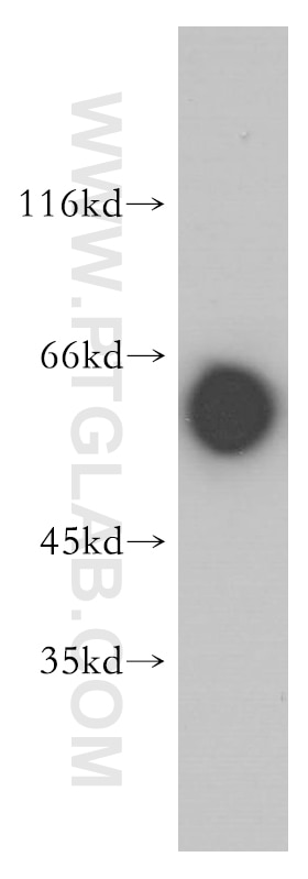 Western Blot (WB) analysis of mouse heart tissue using MTMR6 Polyclonal antibody (13684-1-AP)
