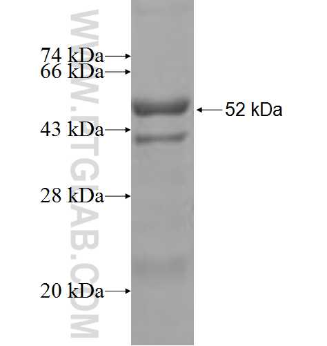 MTMR6 fusion protein Ag4551 SDS-PAGE