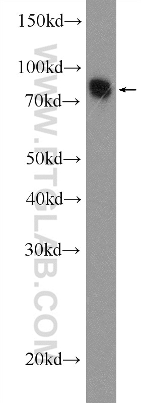 Western Blot (WB) analysis of mouse brain tissue using MTMR7 Polyclonal antibody (25990-1-AP)