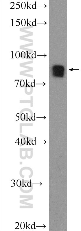 Western Blot (WB) analysis of rat brain tissue using MTMR7 Polyclonal antibody (25990-1-AP)