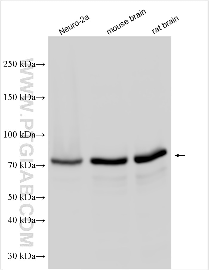 Western Blot (WB) analysis of various lysates using MTMR7 Polyclonal antibody (25990-1-AP)