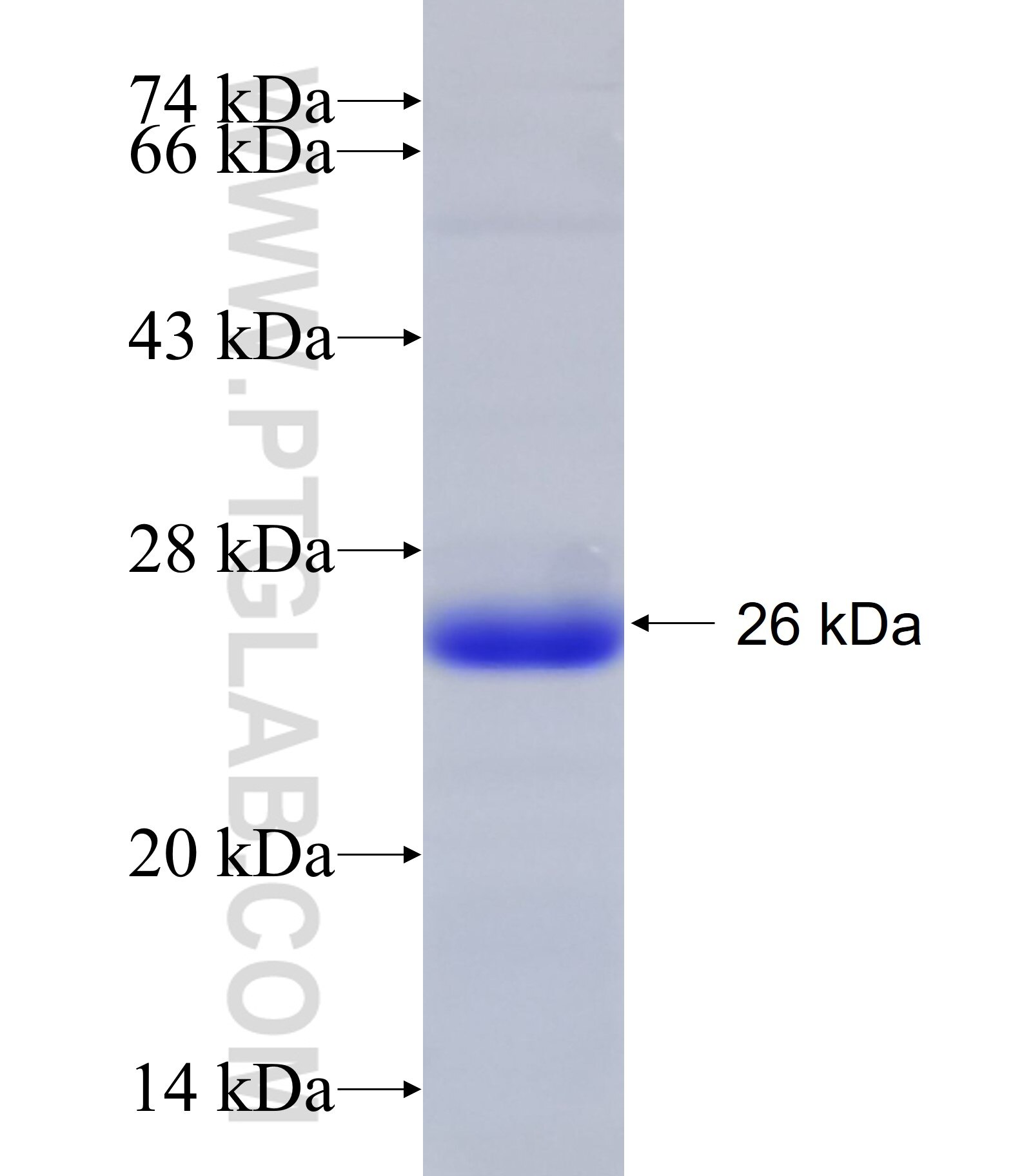 MTMR7 fusion protein Ag23738 SDS-PAGE