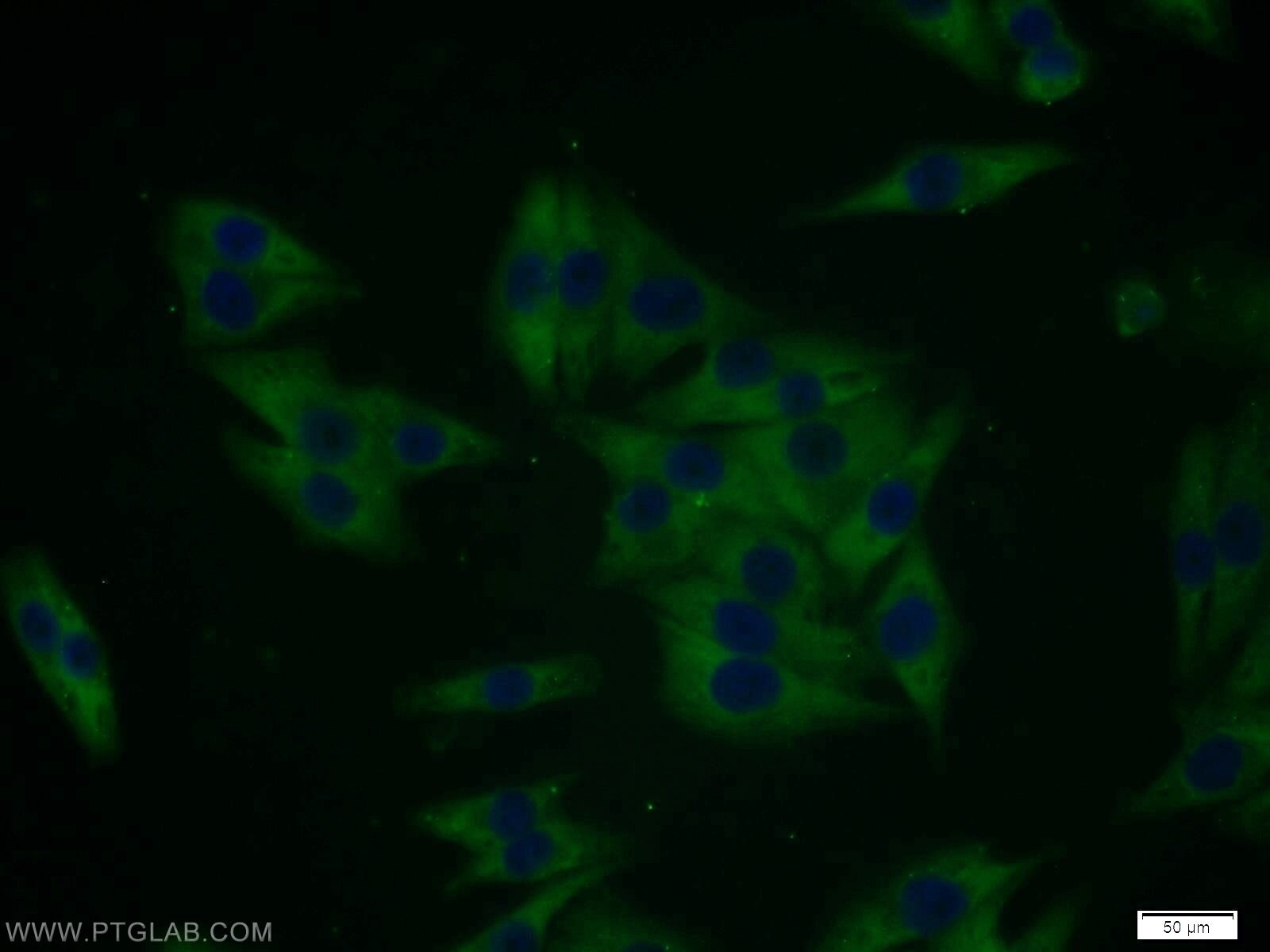 Immunofluorescence (IF) / fluorescent staining of A375 cells using MTMR8 Polyclonal antibody (12299-1-AP)
