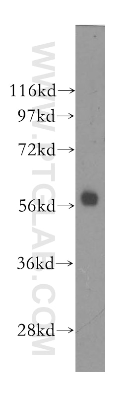 Western Blot (WB) analysis of human placenta tissue using MTMR8 Polyclonal antibody (12299-1-AP)
