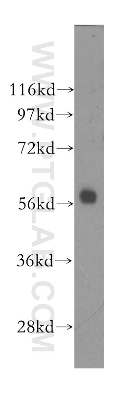 WB analysis of human placenta using 12299-1-AP