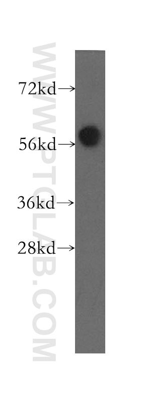 Western Blot (WB) analysis of HeLa cells using MTMR8 Polyclonal antibody (12299-1-AP)