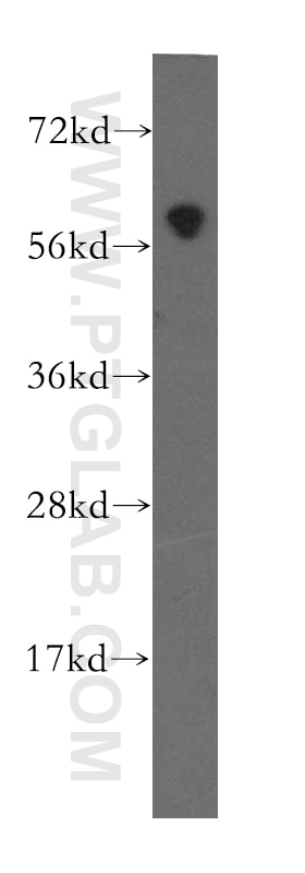 Western Blot (WB) analysis of A375 cells using MTMR8 Polyclonal antibody (12299-1-AP)