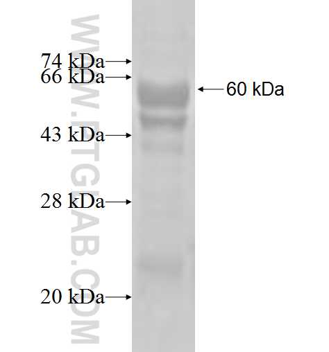 MTMR8 fusion protein Ag2944 SDS-PAGE