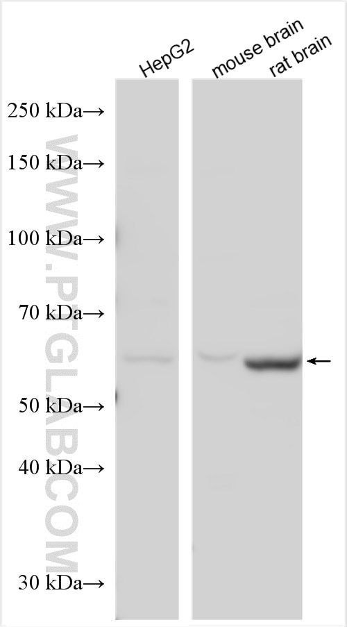 Western Blot (WB) analysis of various lysates using MTMR9 Polyclonal antibody (30468-1-AP)