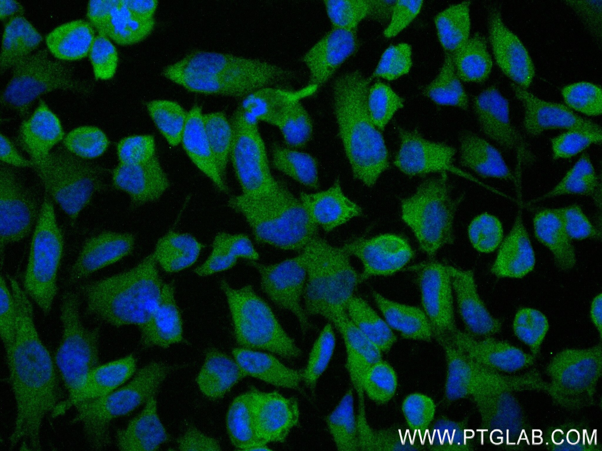 Immunofluorescence (IF) / fluorescent staining of HeLa cells using MTMR9 Recombinant antibody (83694-4-RR)