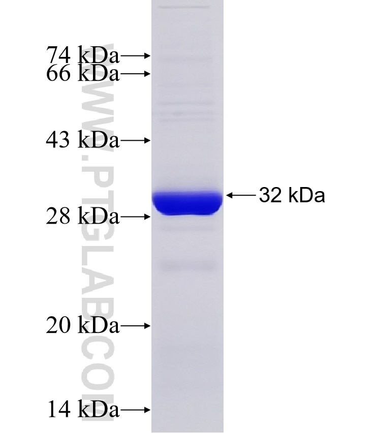 MTMR9 fusion protein Ag33501 SDS-PAGE