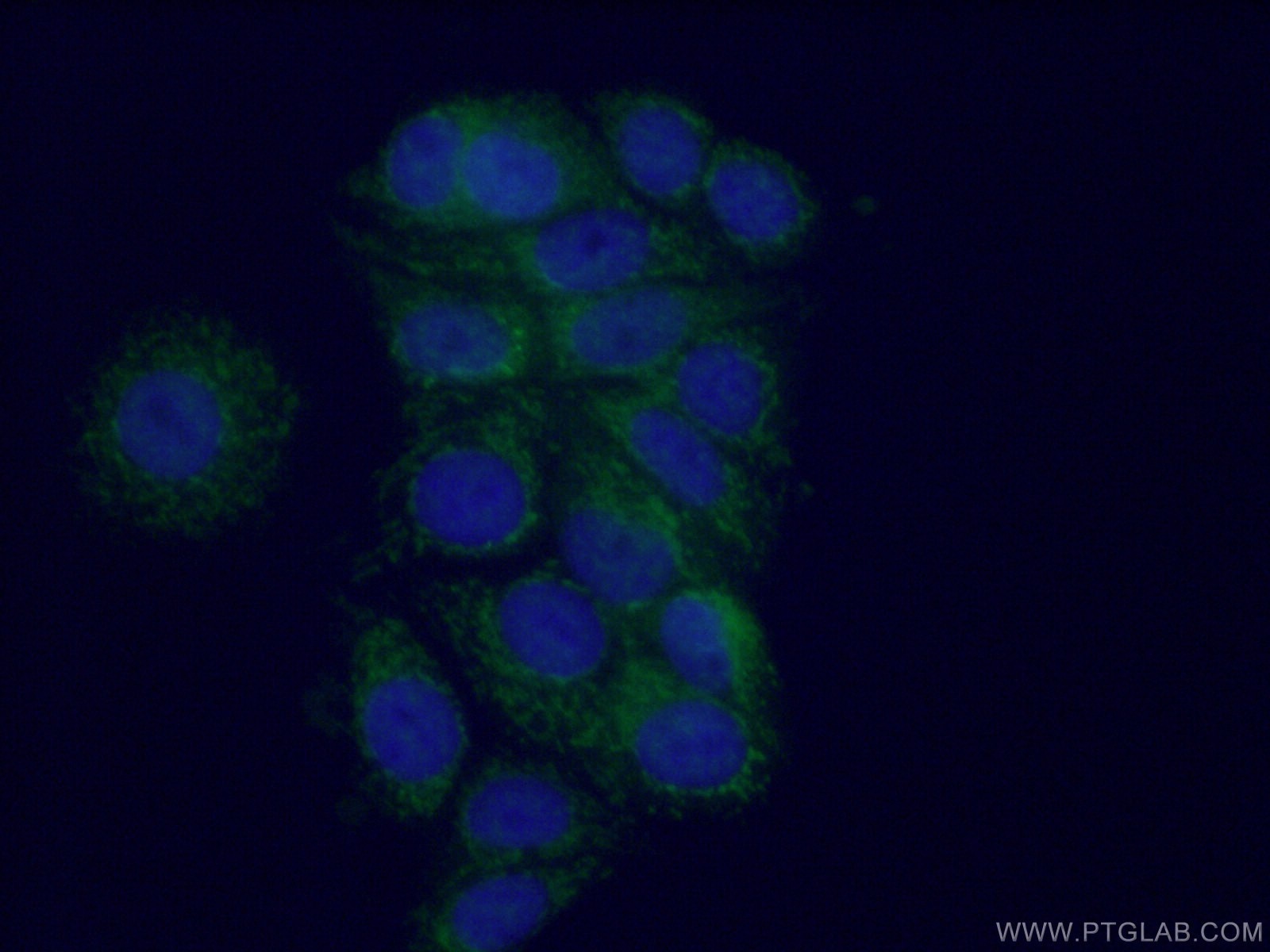 Immunofluorescence (IF) / fluorescent staining of MCF-7 cells using MTO1 Polyclonal antibody (15650-1-AP)