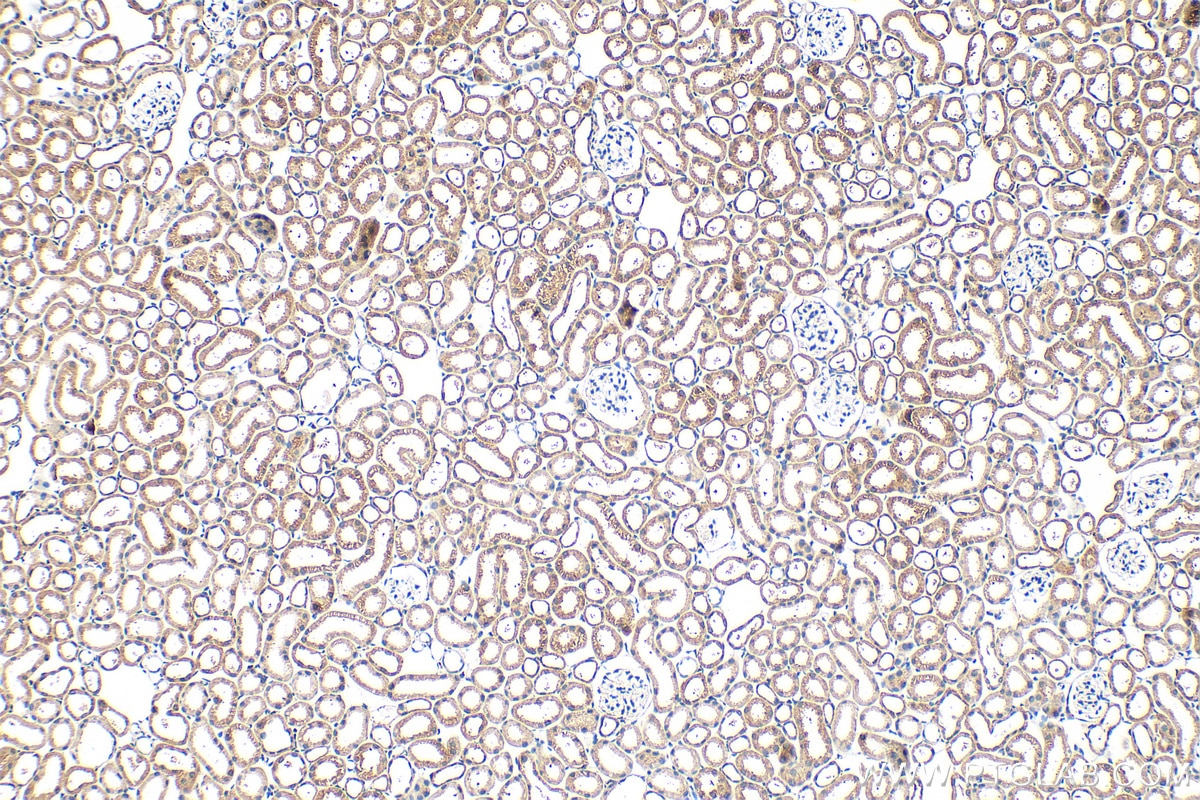 Immunohistochemistry (IHC) staining of mouse kidney tissue using MTO1 Polyclonal antibody (15650-1-AP)