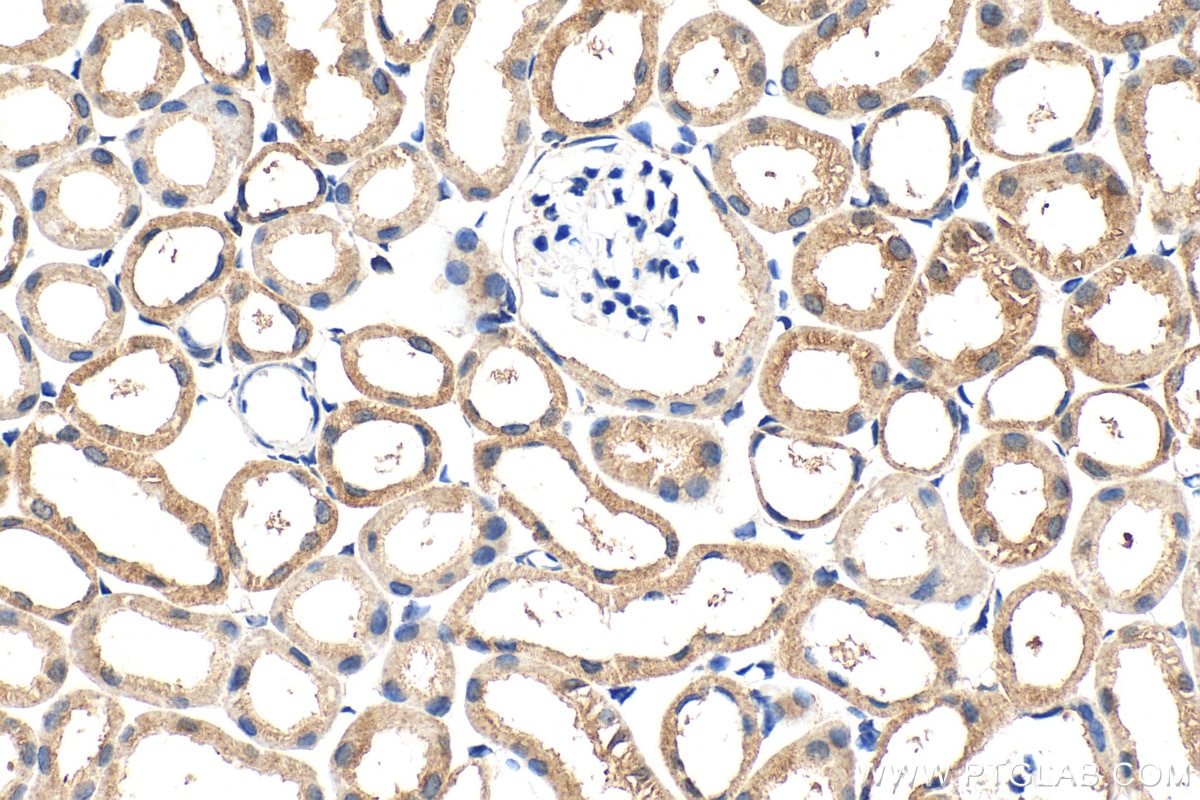 Immunohistochemistry (IHC) staining of mouse kidney tissue using MTO1 Polyclonal antibody (15650-1-AP)