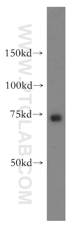 Western Blot (WB) analysis of human liver tissue using MTO1 Polyclonal antibody (15650-1-AP)