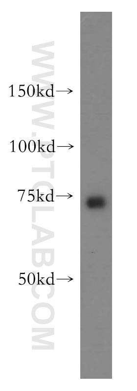 WB analysis of human liver using 15650-1-AP