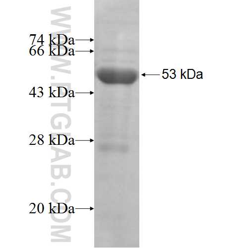 MTO1 fusion protein Ag8204 SDS-PAGE