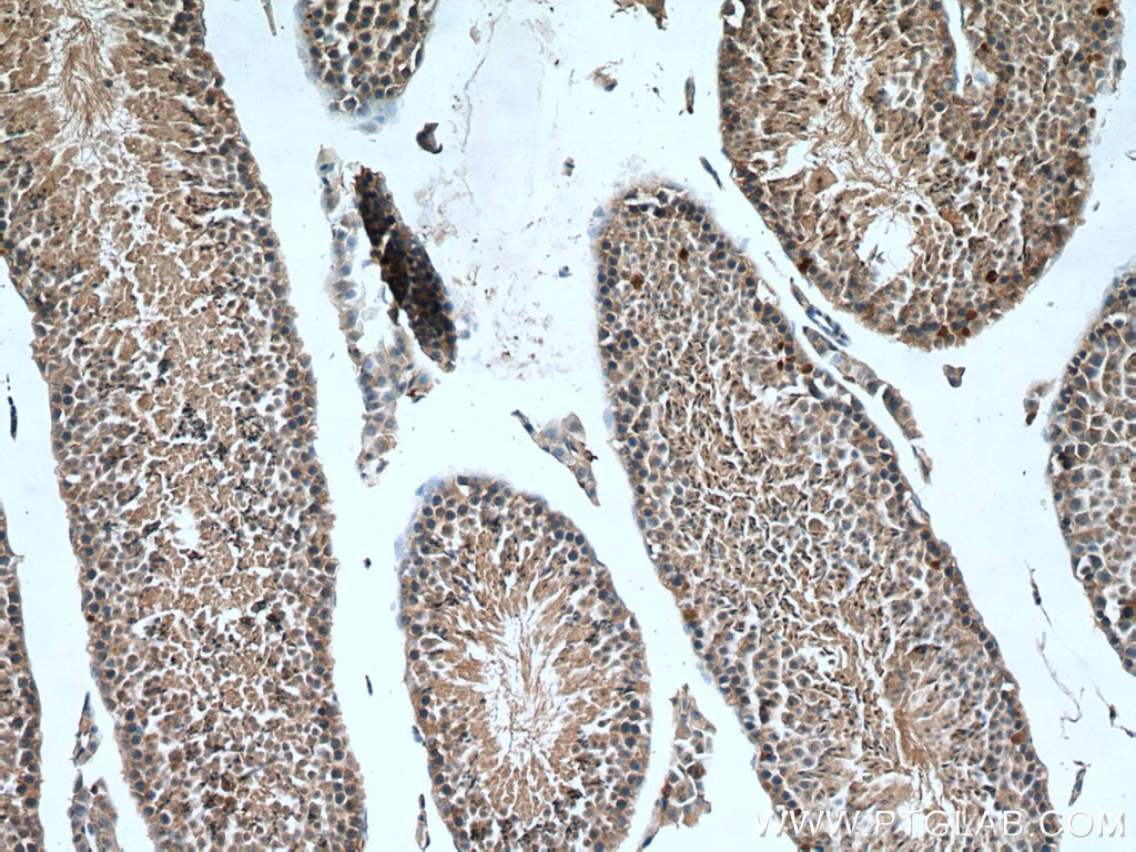 Immunohistochemistry (IHC) staining of mouse testis tissue using mTOR Polyclonal antibody (20657-1-AP)