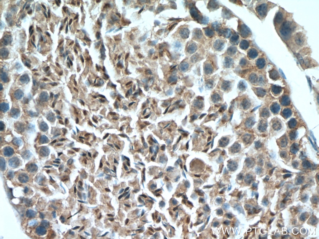 Immunohistochemistry (IHC) staining of mouse testis tissue using mTOR Polyclonal antibody (20657-1-AP)