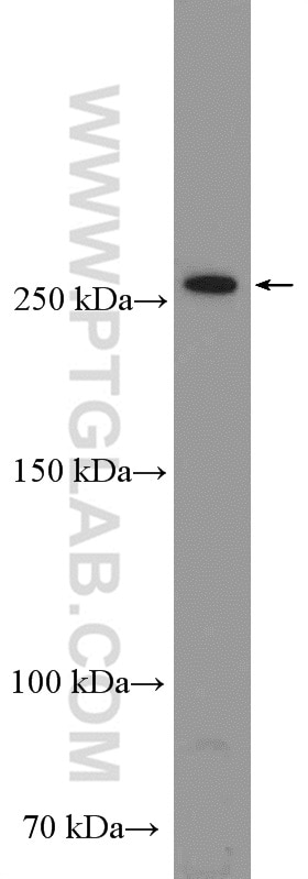 Western Blot (WB) analysis of MDA-MB-453s cells using mTOR Polyclonal antibody (20657-1-AP)
