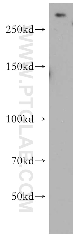 mTOR Polyclonal antibody