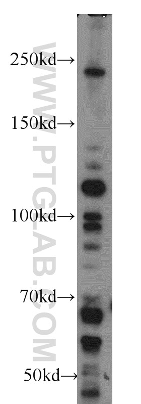 Western Blot (WB) analysis of HeLa cells using mTOR Polyclonal antibody (20657-1-AP)