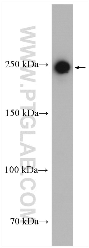 WB analysis of MCF-7 using 28273-1-AP