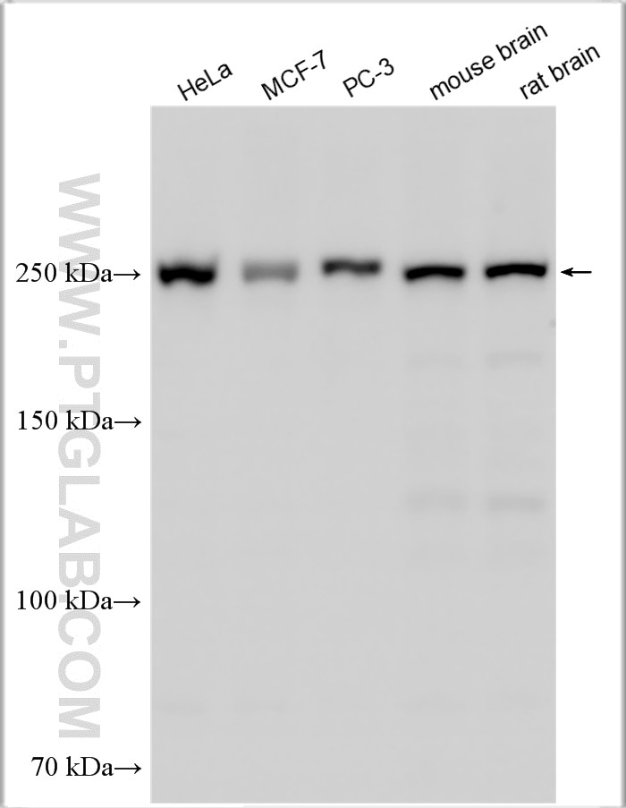 Western Blot (WB) analysis of various lysates using mTOR Polyclonal antibody (28273-1-AP)