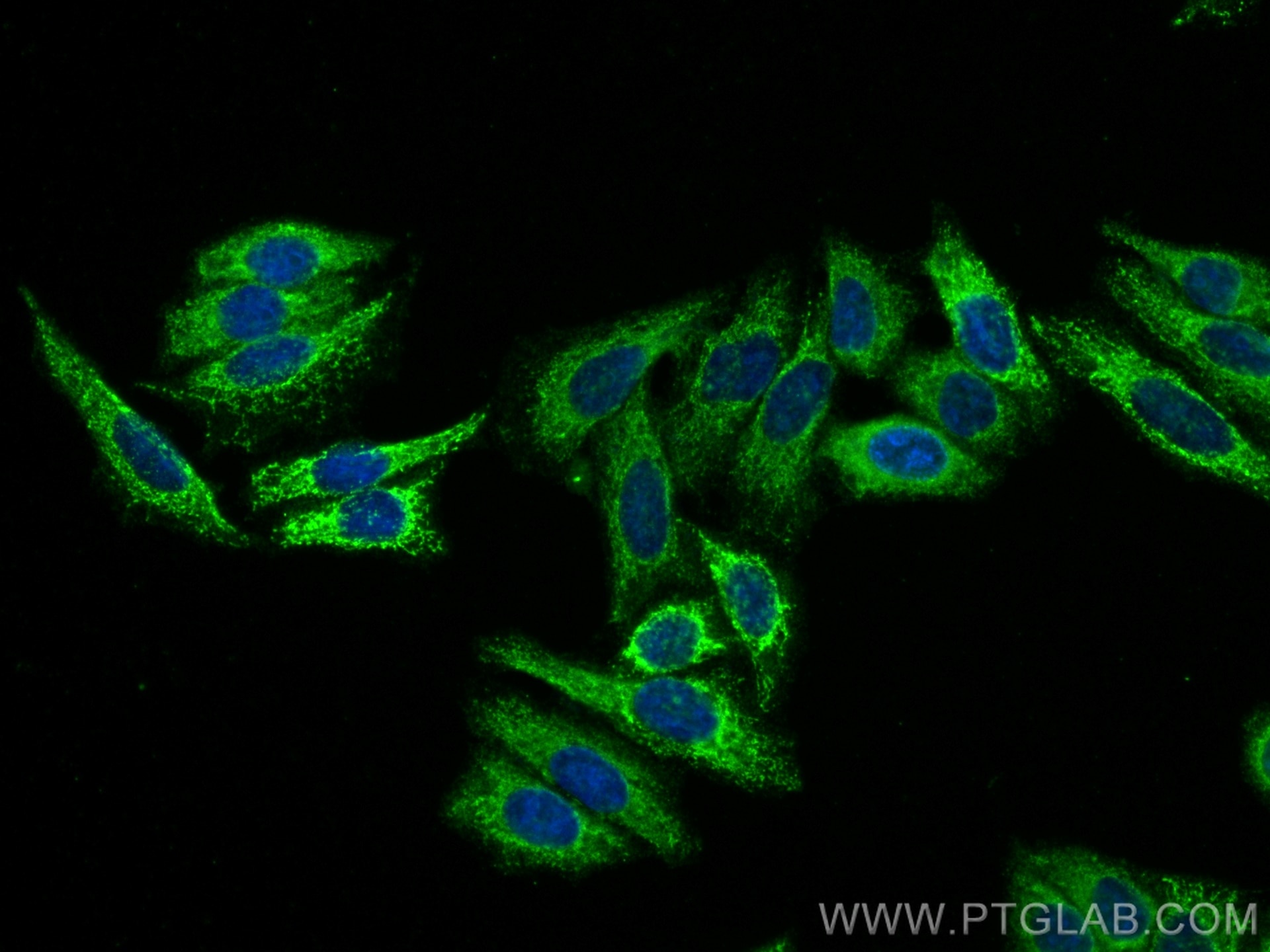 Immunofluorescence (IF) / fluorescent staining of HepG2 cells using mTOR Monoclonal antibody (66888-1-Ig)