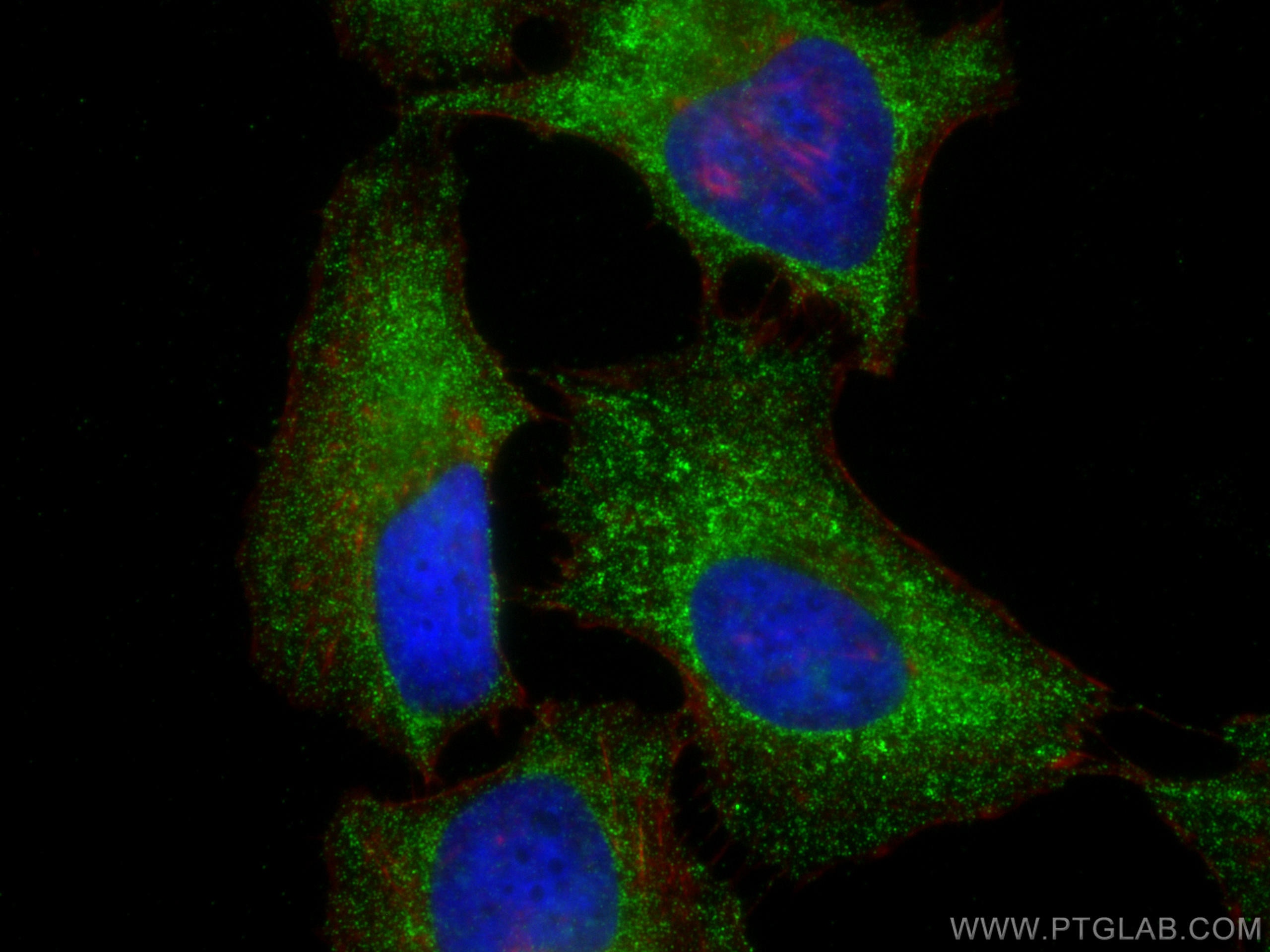 Immunofluorescence (IF) / fluorescent staining of HeLa cells using mTOR Monoclonal antibody (66888-1-Ig)