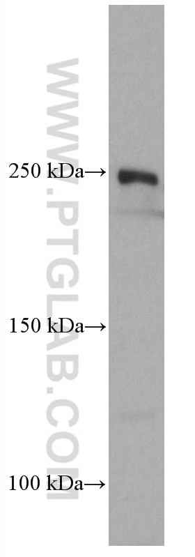 Western Blot (WB) analysis of ROS1728 cells using mTOR Monoclonal antibody (66888-1-Ig)