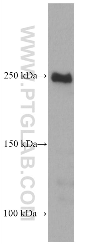 Western Blot (WB) analysis of rat brain tissue using mTOR Monoclonal antibody (66888-1-Ig)