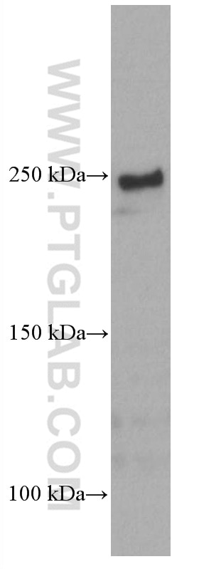 Western Blot (WB) analysis of mouse brain tissue using mTOR Monoclonal antibody (66888-1-Ig)