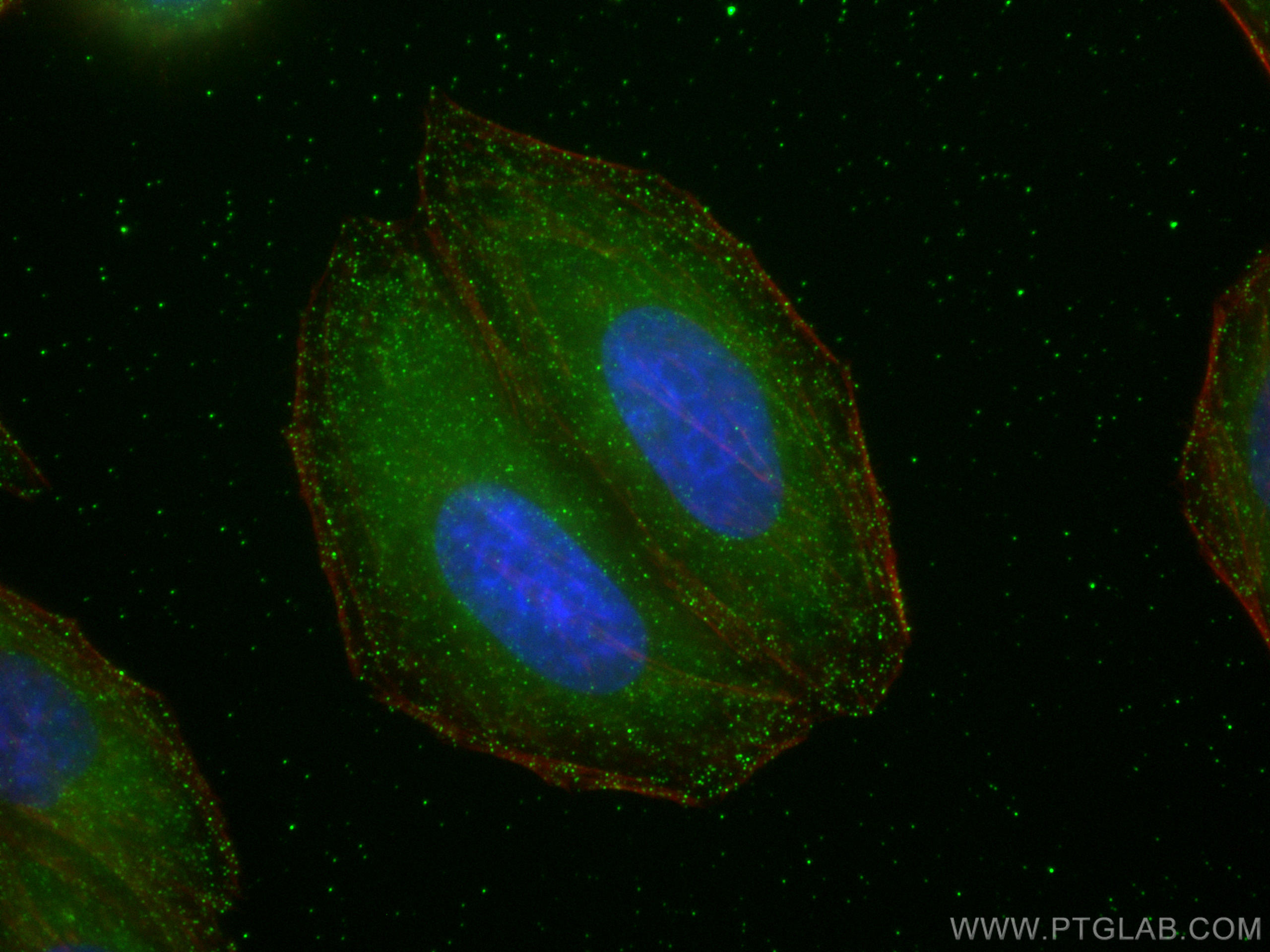 Immunofluorescence (IF) / fluorescent staining of HepG2 cells using mTOR Recombinant antibody (81670-1-RR)