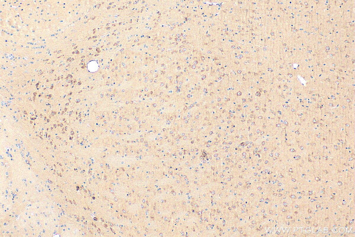 Immunohistochemical analysis of paraffin-embedded mouse brain tissue slide using 81670-1-RR (mTOR antibody) at dilution of 1:400 (under 10x lens). Heat mediated antigen retrieval with Tris-EDTA buffer (pH 9.0). This data was developed using the same antibody clone with 81670-1-PBS in a different storage buffer formulation. Immunohistochemistry (IHC) staining of mouse brain tissue using mTOR Recombinant monoclonal antibody (81670-1-RR)