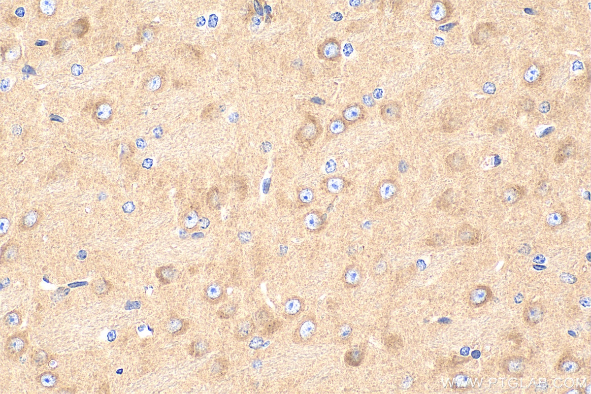 Immunohistochemical analysis of paraffin-embedded mouse brain tissue slide using 81670-1-RR (mTOR antibody) at dilution of 1:400 (under 40x lens). Heat mediated antigen retrieval with Tris-EDTA buffer (pH 9.0). This data was developed using the same antibody clone with 81670-1-PBS in a different storage buffer formulation. Immunohistochemistry (IHC) staining of mouse brain tissue using mTOR Recombinant monoclonal antibody (81670-1-RR)