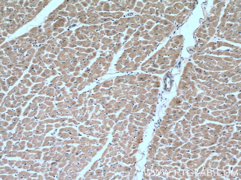 Immunohistochemistry (IHC) staining of human heart tissue using MTP18 Polyclonal antibody (14257-1-AP)