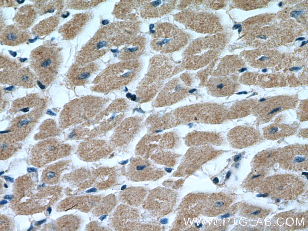 Immunohistochemistry (IHC) staining of human heart tissue using MTP18 Polyclonal antibody (14257-1-AP)