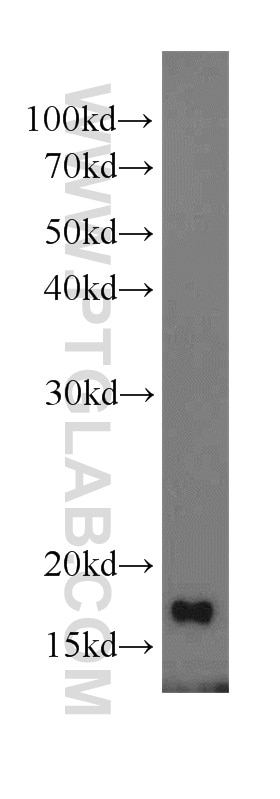 WB analysis of mouse heart using 14257-1-AP